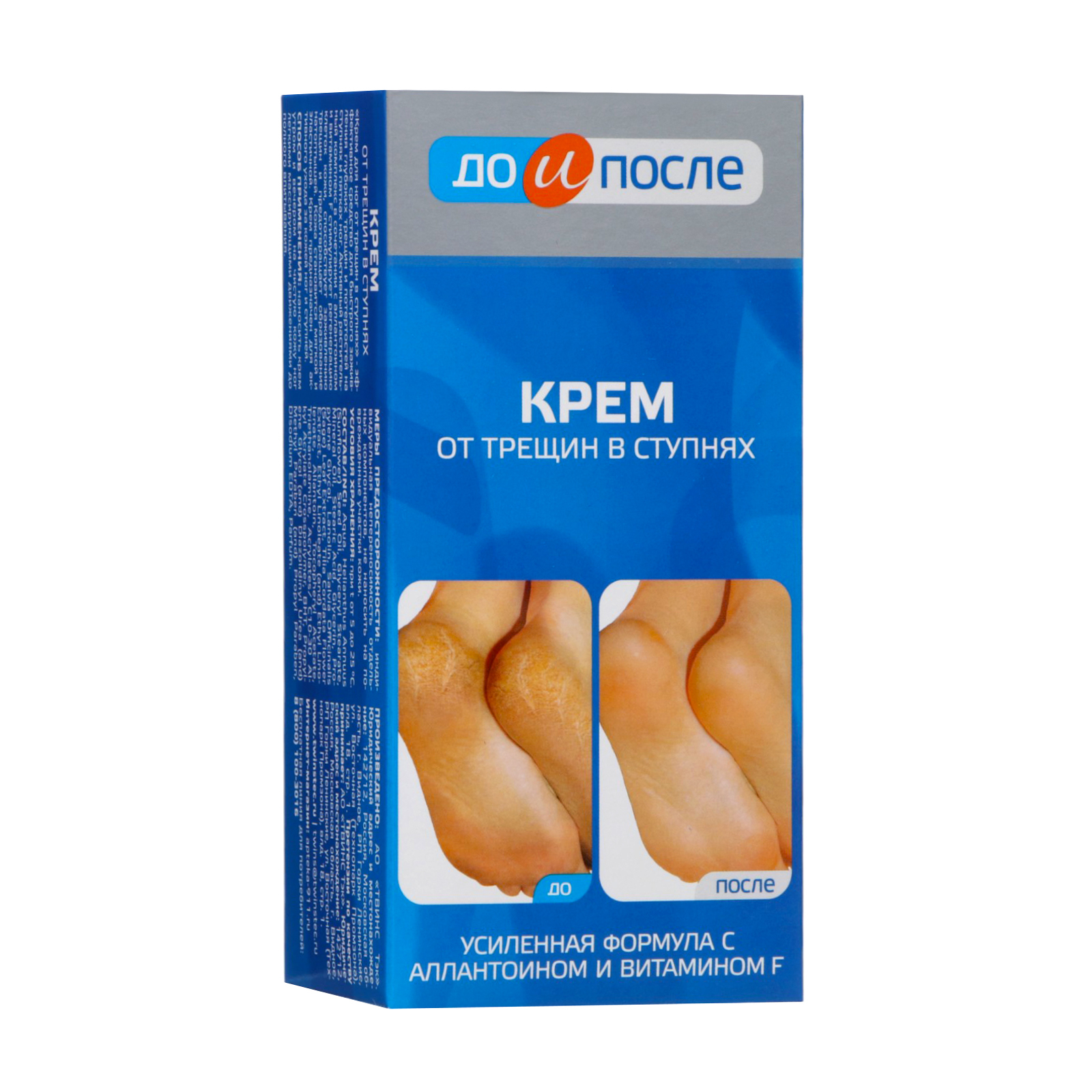 Крем до и после от трещин отзывы Крем до и после от трещин отзывы