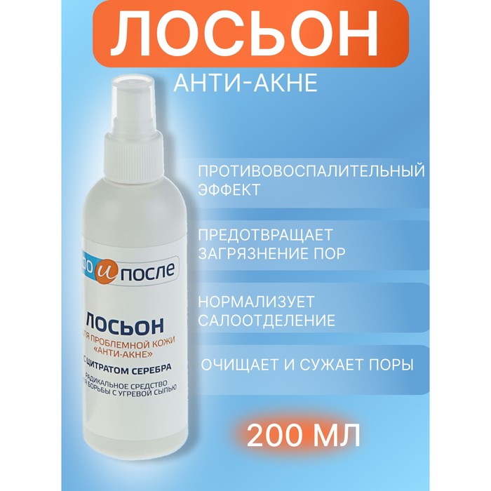 Лосьон «До и После» Анти-Акне для проблемной кожи, 200 мл - Фото 1