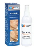 Лосьон «До и После» Анти-Акне для проблемной кожи, 200 мл - Фото 4