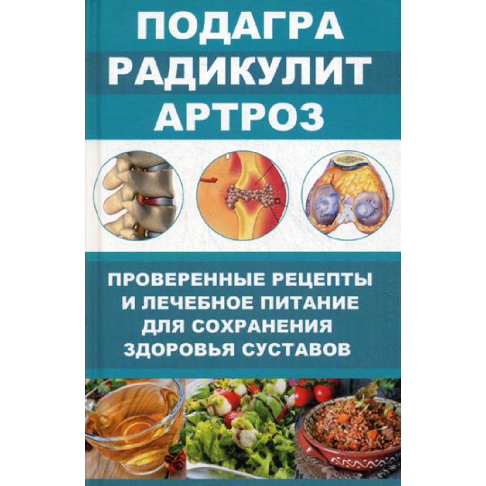 Подагра, радикулит, артроз. Проверенные рецепты и лечебное питание для  сохранения здоровья суставов. Романова М.Ю.