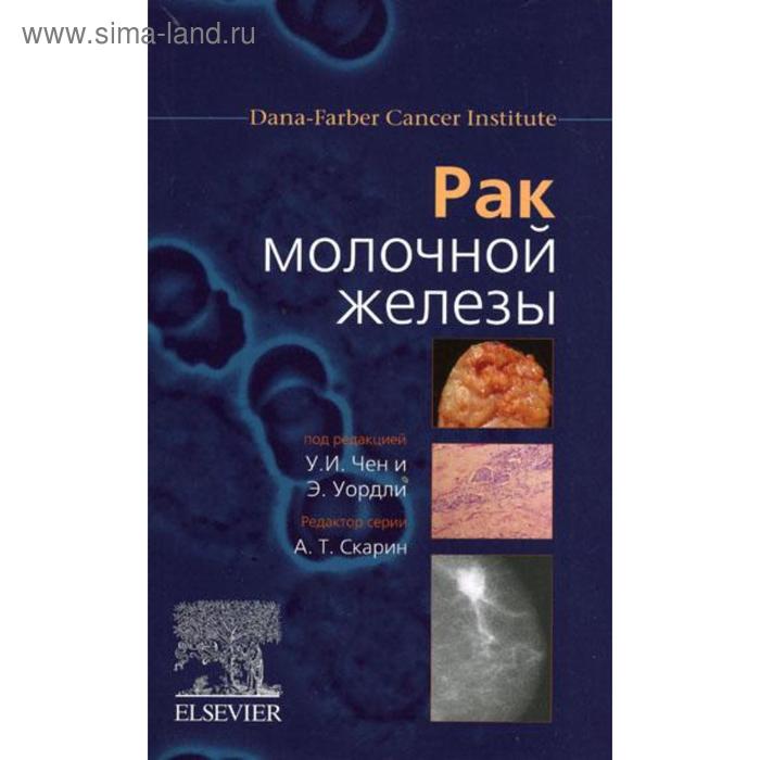 Рак молочной железы. Под ред. Чен У.И., Уордли Э. - Фото 1