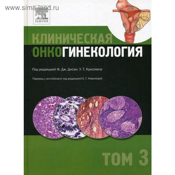 Клиническая онкогинекология. В 3 т. Т. 3. Под ред. Ф.Дж. Дисаи, У.Т. Крисмана - Фото 1