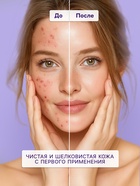 Пилинг-ПЭДЫ для лица Sendo c BHA- кислотами, обновляющие, 80 мл - Фото 2