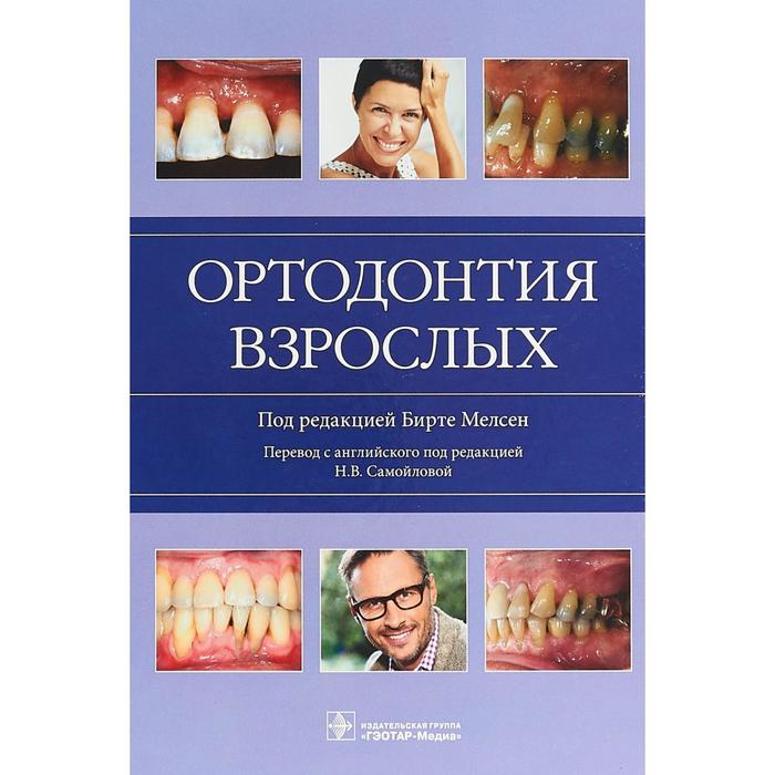 Ортодонтия взрослых. Под ред. Бирте М