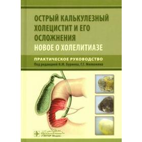 Буриев, Мелконян, Веденина: Острый калькулезный холецистит и его осложнения. Новое о холелитиазе. Практическое руководство