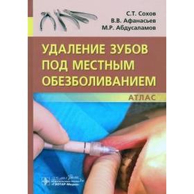 Удаление зубов под местным обезболиванием. Сохов С.