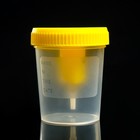 Контейнер стерильный со встроенным устройством для вакуумного забора мочи, 120 мл - Фото 2