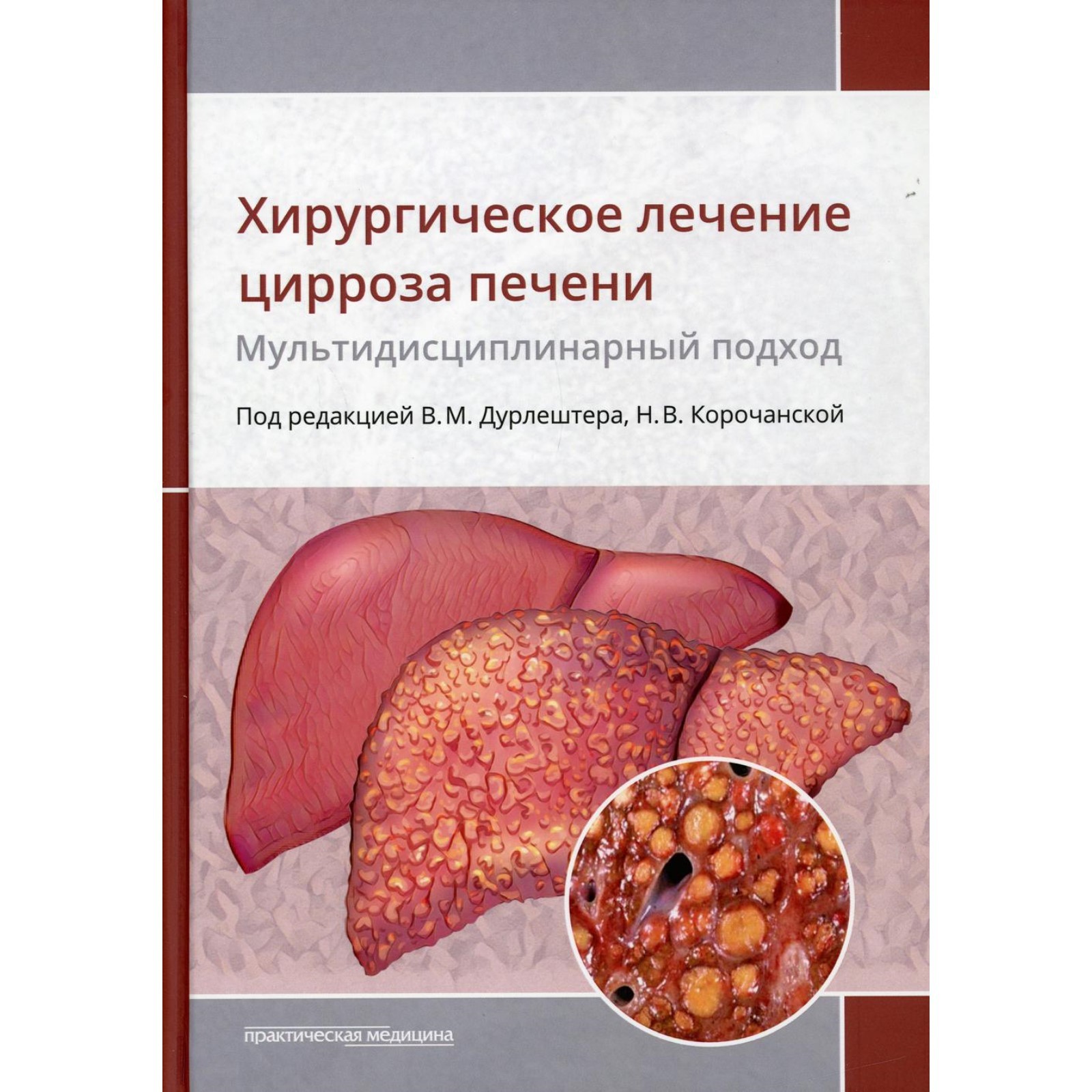 Хирургическое лечение цирроза печени: мультидисциплинарный подход. Габриэль  Сергей Александрович, Дурлештер Владимир Моисеевич, Корочанская Наталья  Всеволодовна (7611261) - Купить по цене от 1 177.00 руб. | Интернет магазин  SIMA-LAND.RU