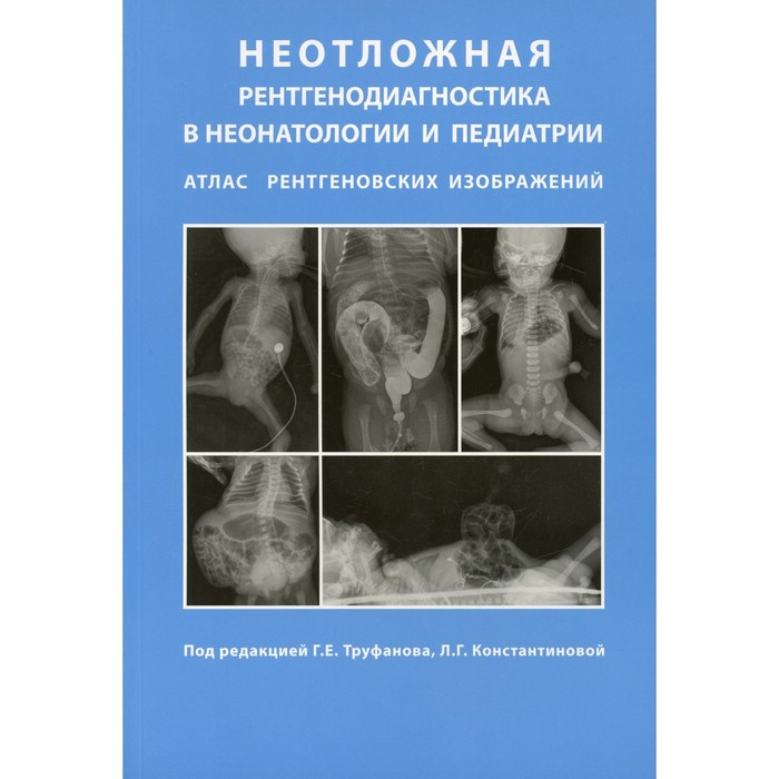 Неотложная рентгенодиагностика в неонатологии и педиатрии атлас рентгеновских изображений