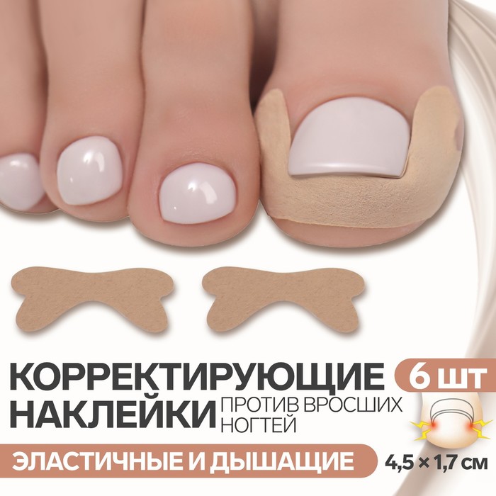 Наклейки против вросших ногтей, 6 шт, 4,5 × 1,7 см, цвет бежевый - Фото 1