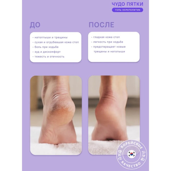 Гель для педикюра "Чудо пятки", 250 мл 28423