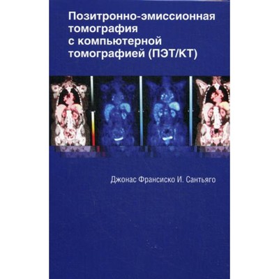 Позитронно-эмиссионная томография с компьютерной томографией (ПЭТ/КТ). Джонас Ф. И. С.
