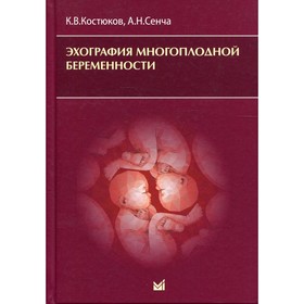 Эхография многоплодной беременности. Костюков К.В., Сенча А.Н.