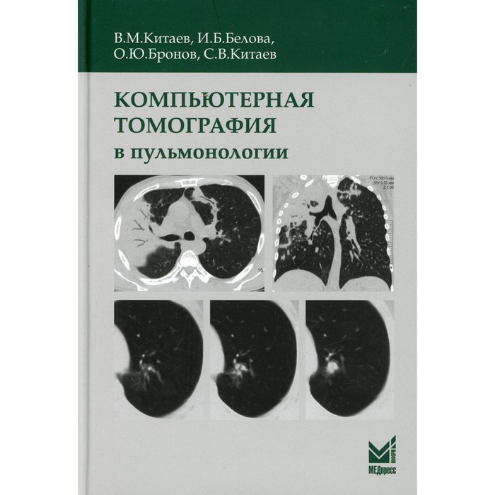 Компьютерная томография в пульмонологии. 3-е издание, дополненное. Китаев В.М., Китаев С.В., Белова И. Б.