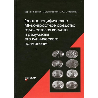 Гепатоспецифическое МР-контрастное средство «гадоксетовая кислота» и результаты его клинического применения. Кармазановский Г.Г., Шантаревич М.Ю., Сташкив В.И.