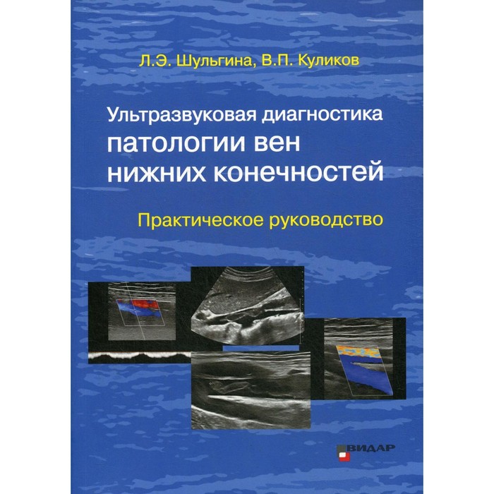 Ультразвуковая диагностика патологии вен нижних конечностей. Шульгина Л.Э.