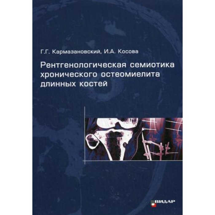 Рентгенологическая семиотика хронического остеомиелита длинных костей. Кармазановский Г.Г. - Фото 1