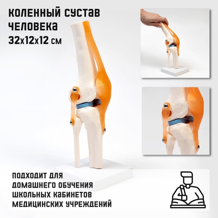 

Макет "Коленный сустав", 32*12*12см