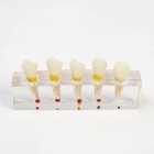 Макет "Строение зуба, заболевания", 10*4*2см - фото 6761216