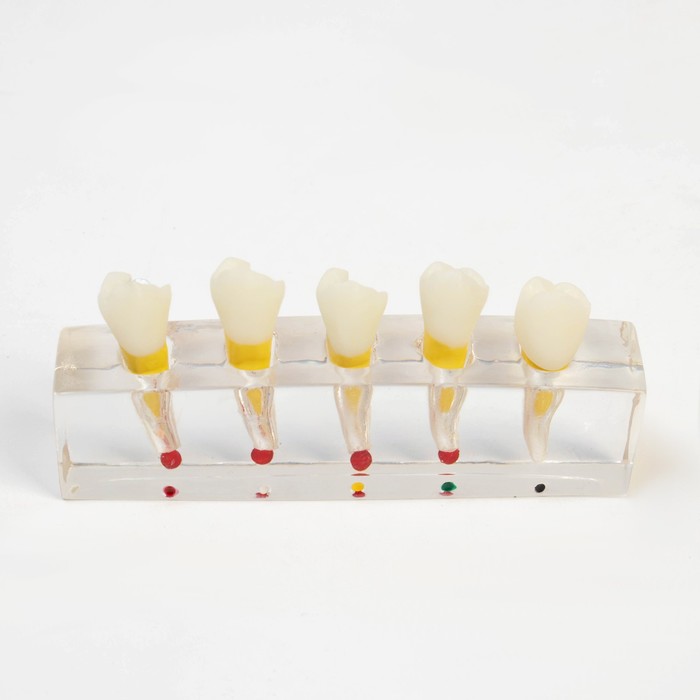 Макет "Строение зуба, заболевания", 10*4*2см - фото 1909049992