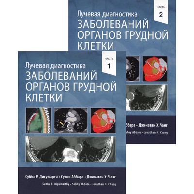 Лучевая диагностика заболеваний органов грудной клетки. В 2-х книгах. Дигумарти С.Р., Чанг Дж.Х., Чанг С.А.