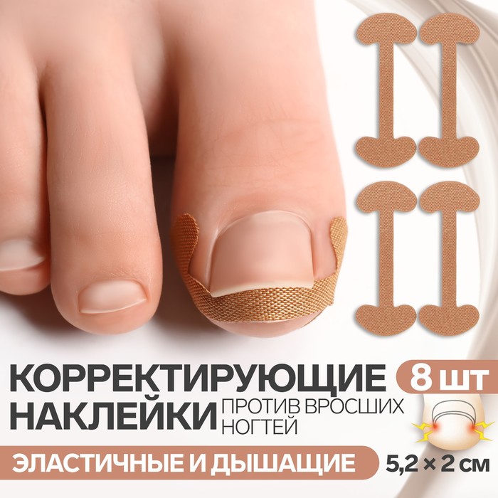 Набор наклеек для коррекции вросших ногтей, 8 шт., 5.2×2 см, бежевый - Фото 1