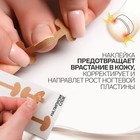Набор наклеек для коррекции вросших ногтей, 8 шт, 5,2 × 2 см, цвет бежевый - фото 9027080
