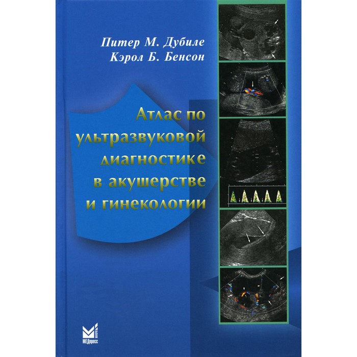 Атлас по ультразвуковой диагностике в акушерстве и гинекологии. 4-е издание. Дубиле П., Бенсон К.Б.