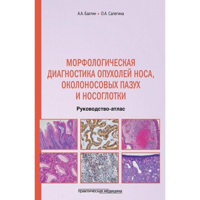 Морфологическая диагностика опухолей носа, околоносовых пазух и носоглотки. Бахтин А.А., Сапегина О.