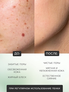 Пенка для умывания, алое вера, 120 мл