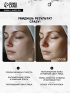 Маска тканевая для лица Consly «После вечеринки», 23 мл - Фото 5