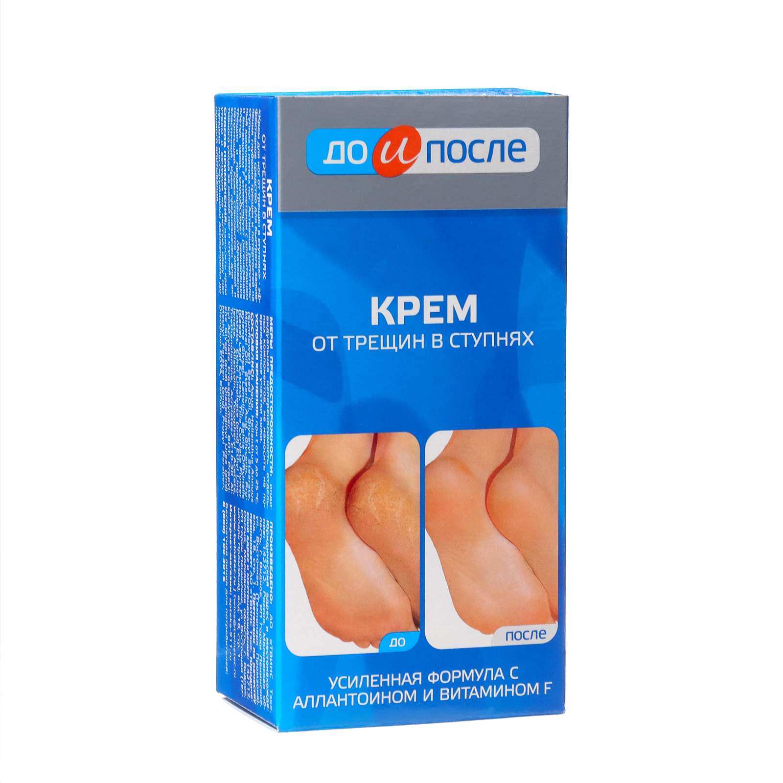 Крем до и после от трещин отзывы Крем до и после от трещин отзывы