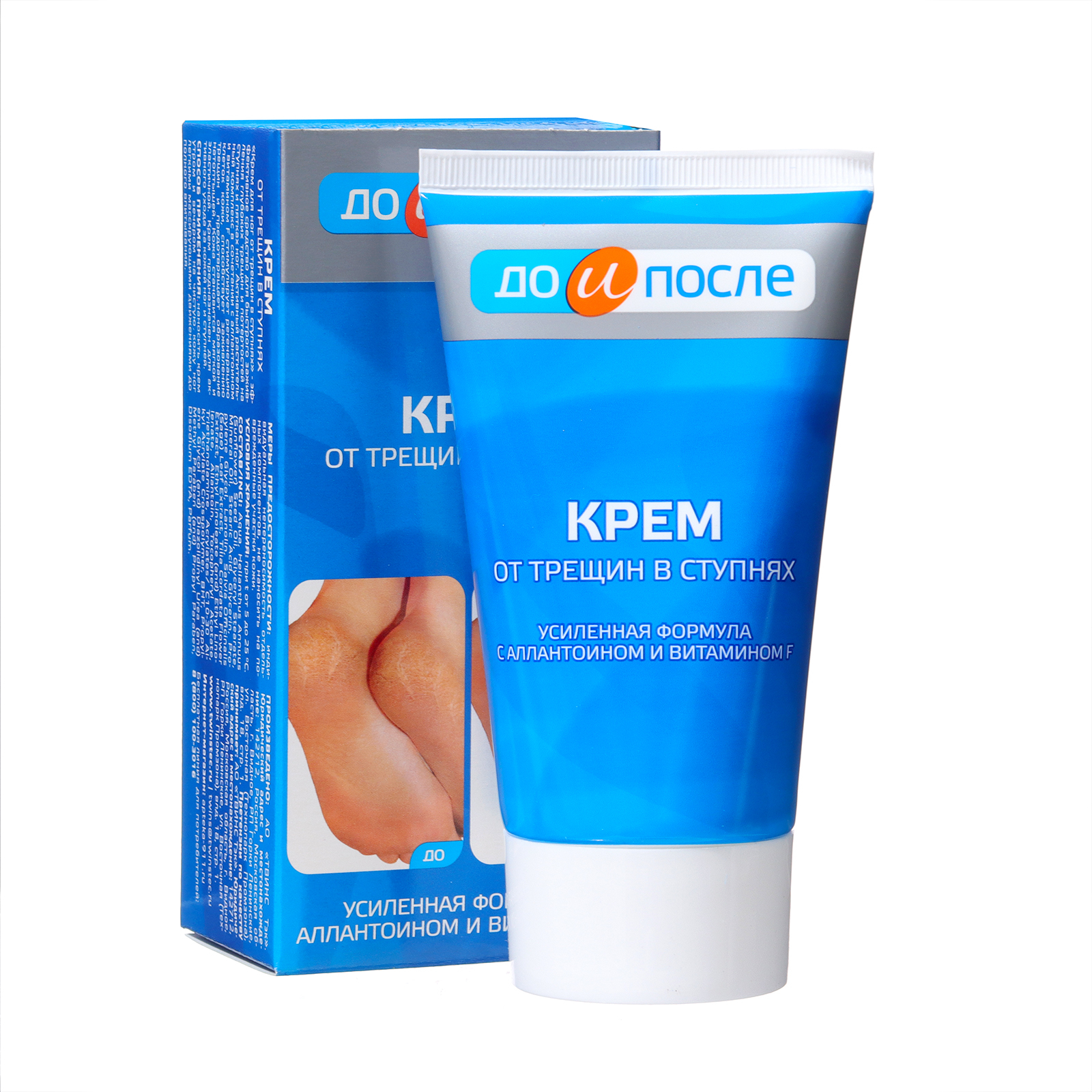 Крем до и после от трещин отзывы Крем до и после от трещин отзывы