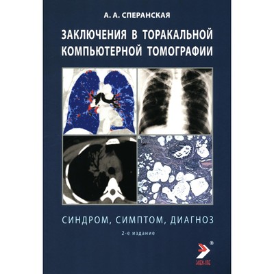 Заключение в торакальной компьютерной томографии. Симптом, синдром, диагноз. 2-е издание. Сперанская А.А.