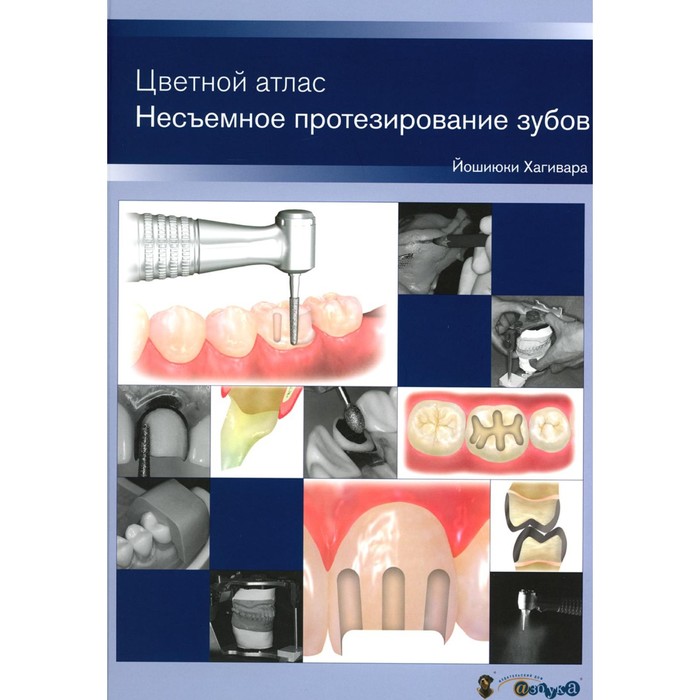 Несъемное протезирование зубов. Цветной атлас. Хагивара Й. - Фото 1