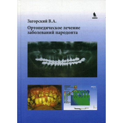 Ортопедическое лечение заболеваний пародонта. Загорский В.А.