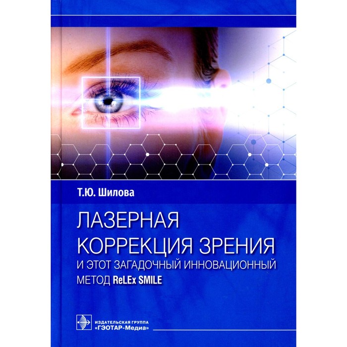 Лазерная коррекция зрения и этот загадочный инновационный метод ReLEx SMILE. Шилова Т.Ю. - Фото 1