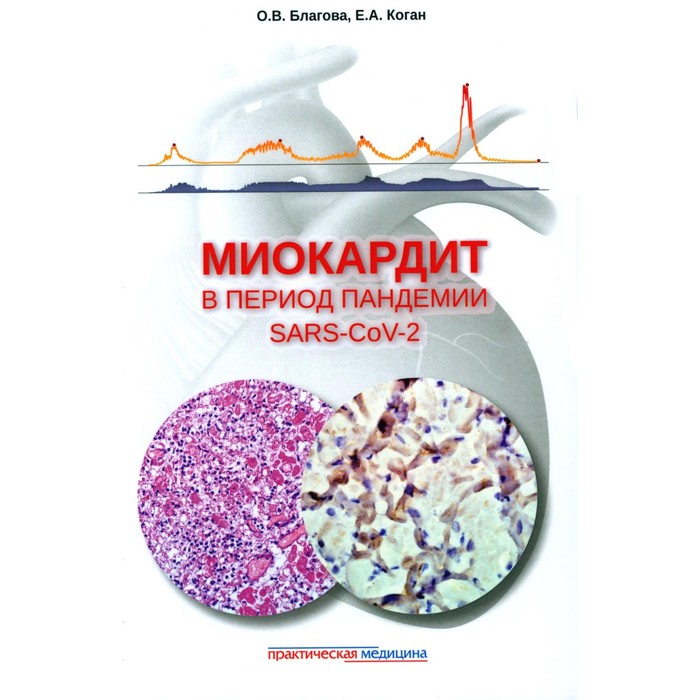 Миокардит в период пандемии SARS-CoV-2. Благова О.В., Коган Е.А. - Фото 1