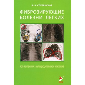 Фиброзирующие болезни лёгких. Роль рентгенолога в мультидисциплинарном консилиуме. Сперанская А.А.