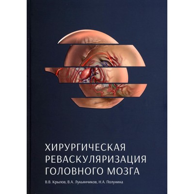 Хирургическая реваскуляризация головного мозга. Крылов В.В., Лукьянчиков В.А., Полунина Н.А.