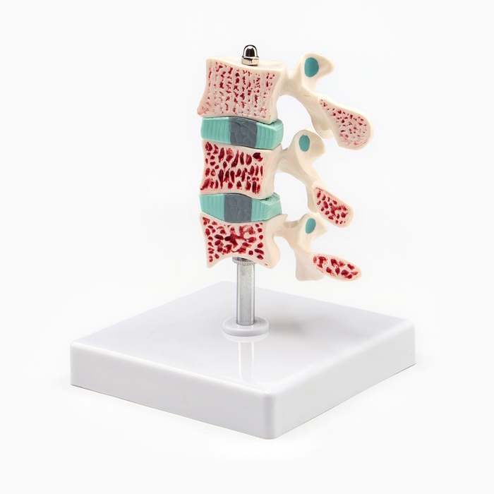 Анатомическая модель «Макет позвоночника в разрезе», 8×7 см - Фото 1
