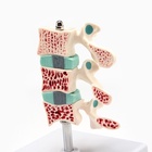 Анатомическая модель «Макет позвоночника в разрезе», 8×7 см - Фото 4