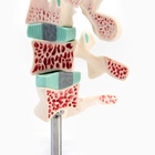 Анатомическая модель «Макет позвоночника в разрезе», 8×7 см - Фото 6