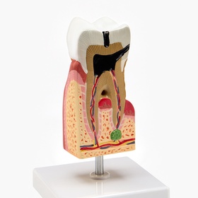 Макет "Строение зуба в разрезе" 13*6см 10681562
