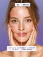 Гель для умывания SENDO с кислотами AHA+BHA complex cleansing gel, 200 мл - Фото 3