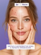 Тоник для лица SENDO с кислотами AHA+BHA complex face tonic, 250 мл - Фото 3