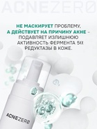Пенка для умывания «Акнестоп» для проблемной кожи лица, 150 мл 10897843 - фото 16591233