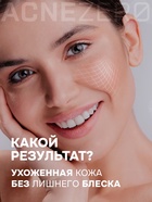 Крем дневной матирующий «Акнестоп» для проблемной кожи лица, 30 мл 10897845 - фото 16591247