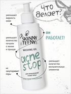 Гель для умывания Skinny Teeny для проблемной кожи лица, 195 мл - фото 46256929