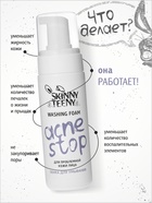 Пенка для умывания Skinny Teeny для проблемной кожи лица, 150 мл - Фото 2